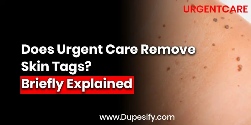 Does Urgent Care Remove Skin Tags?