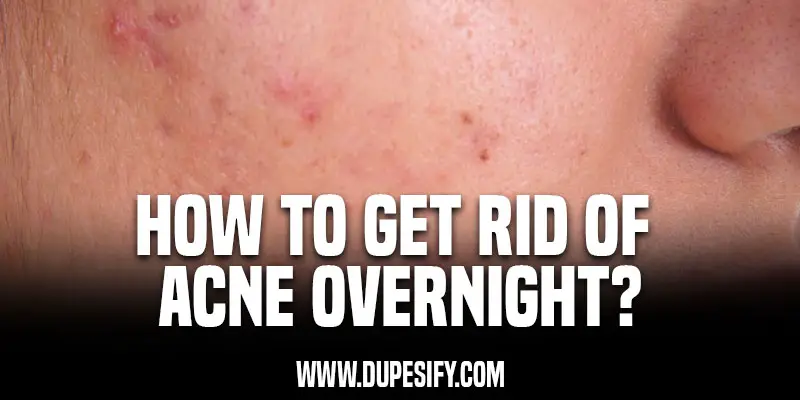 How to Get Rid of Acne Overnight?