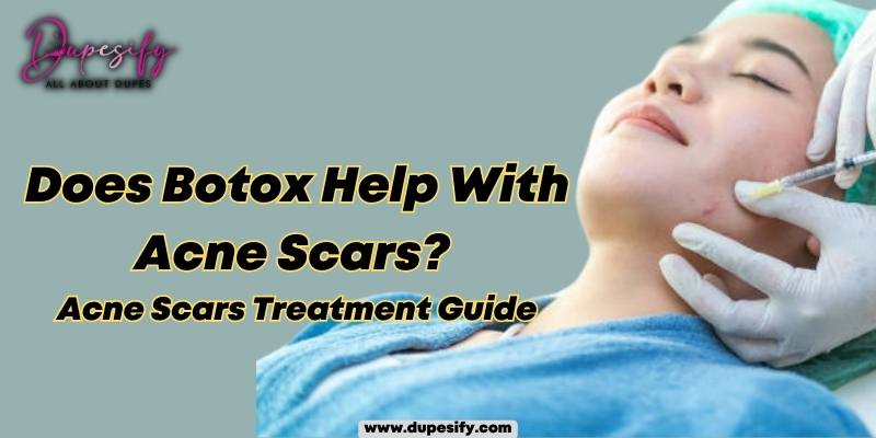 Does Botox Help With Acne Scars? Acne Scars Treatment Guide